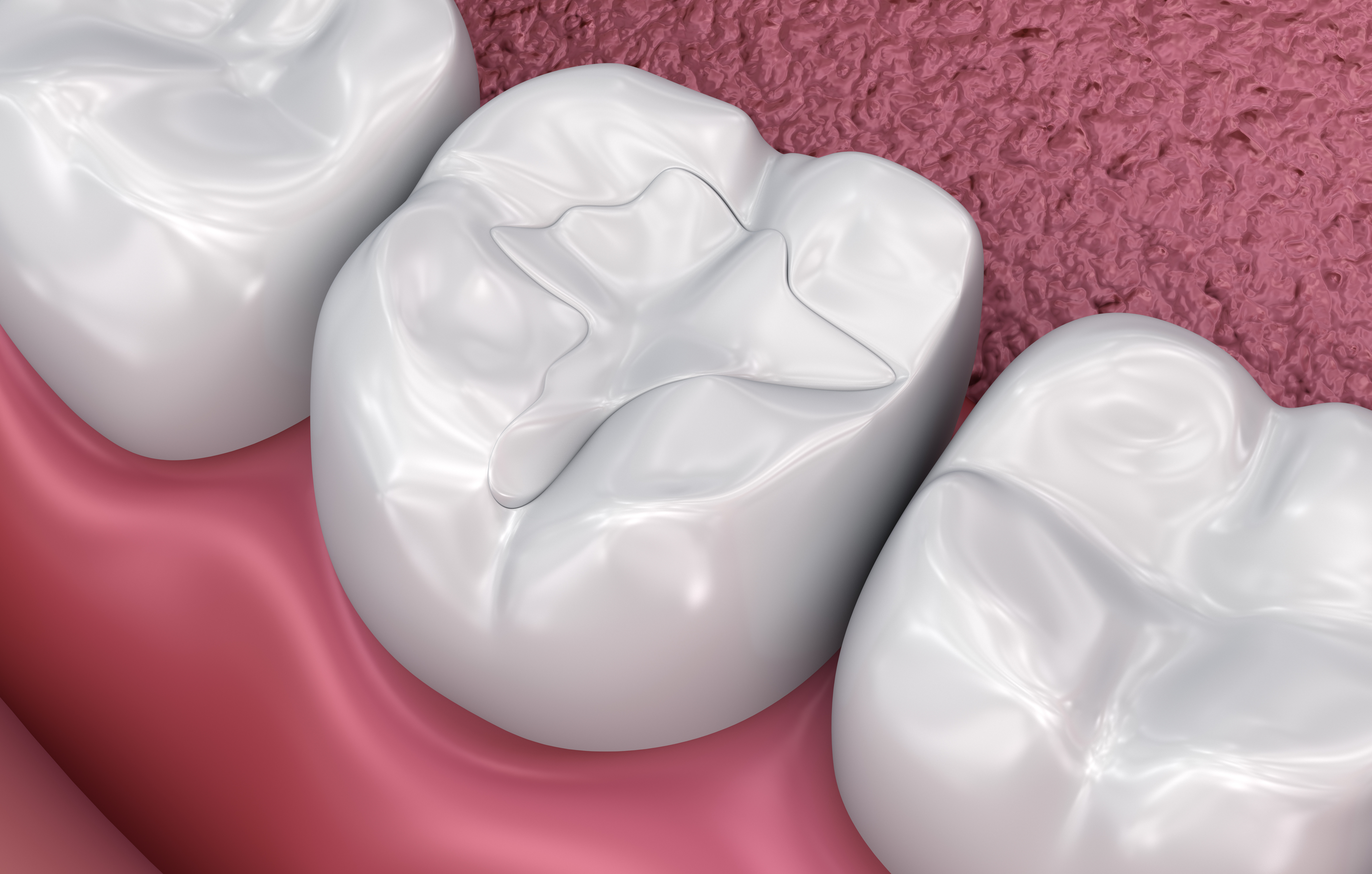 The Role of Fluoride in Protecting Your Family’s Teeth