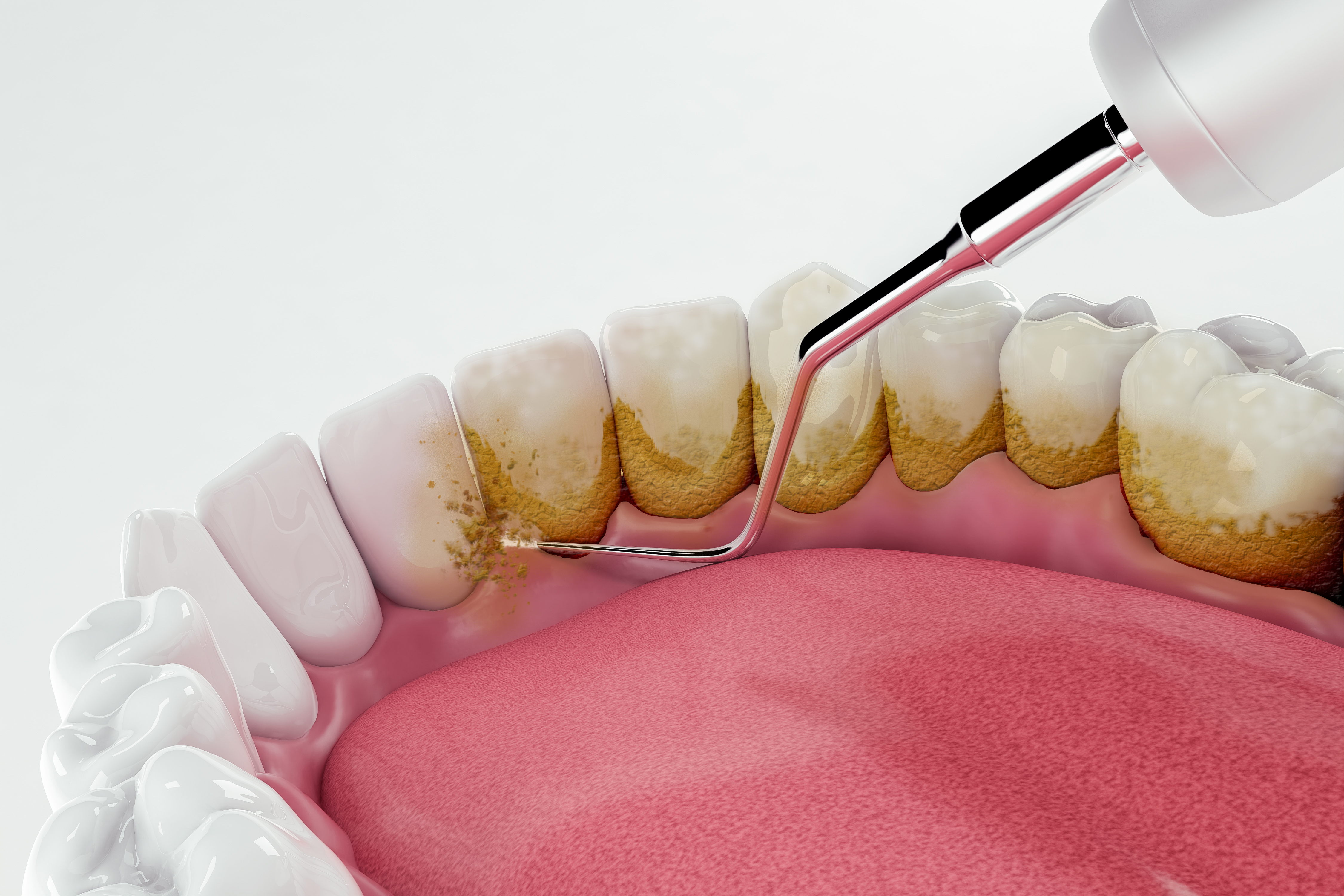 Preventive Care at Integrity Dental Group