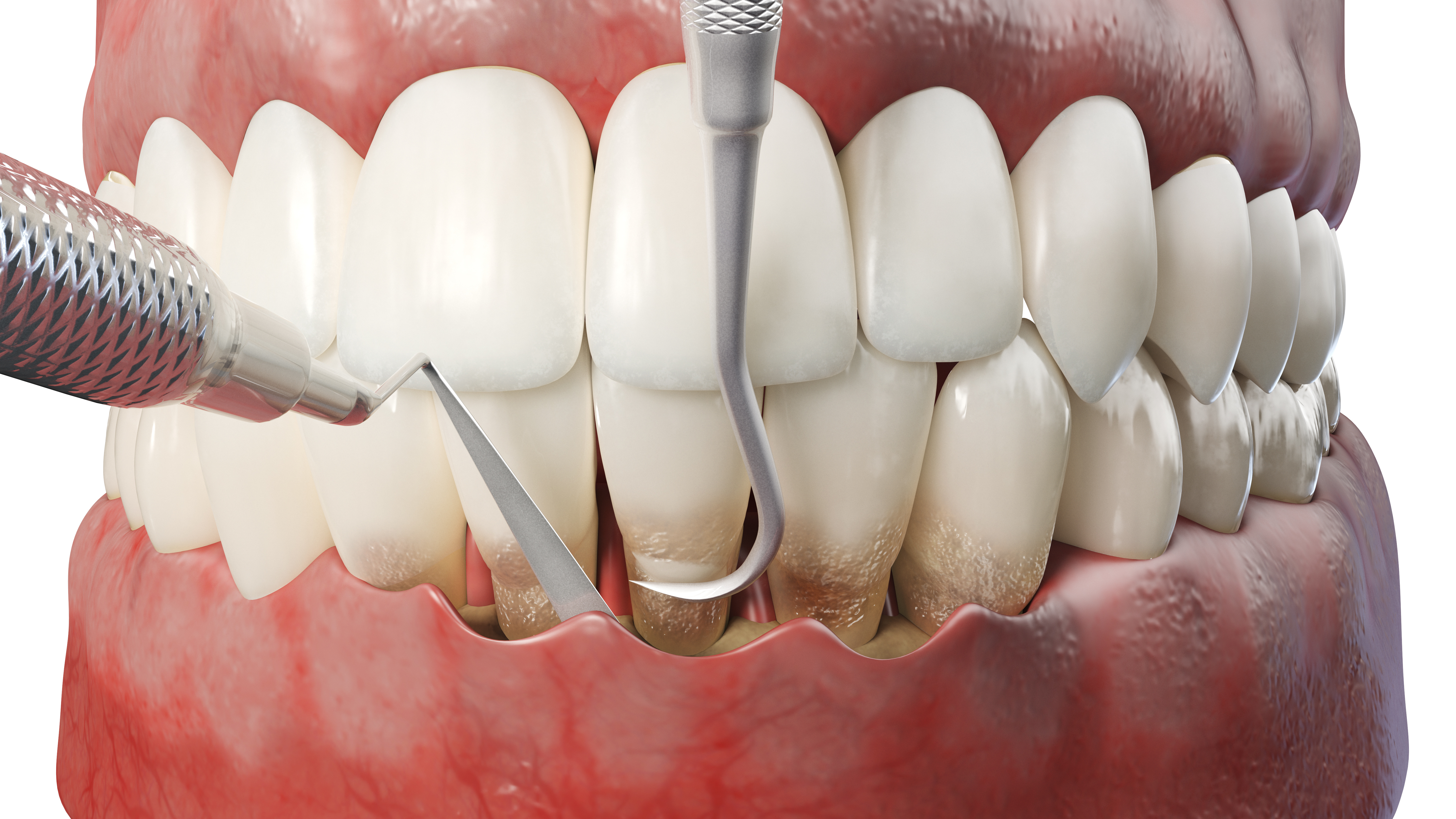 Periodontal Care at Integrity Dental Group