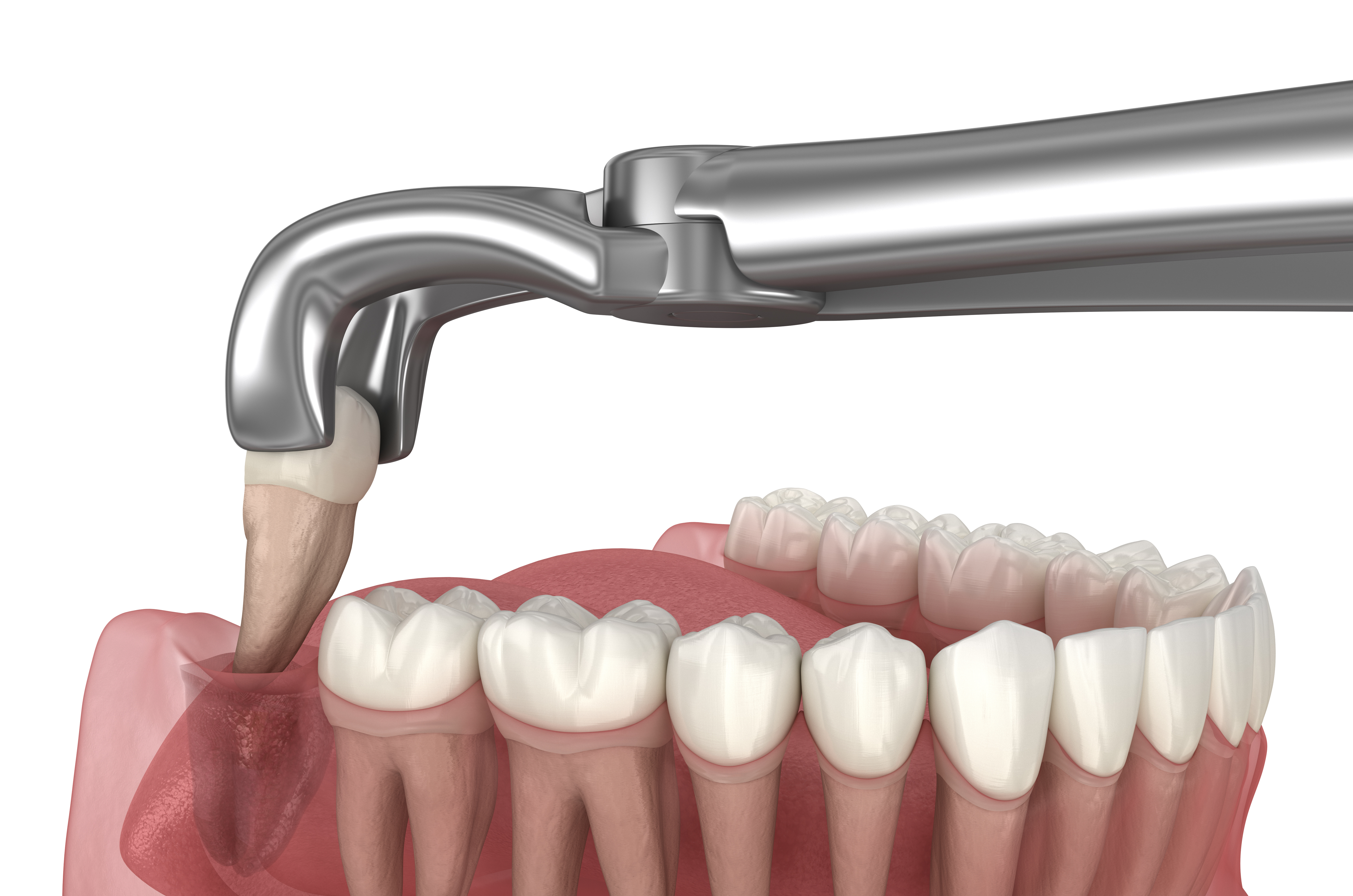 Emergency Dental Care at Integrity Dental Group
